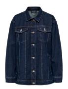 Onljagger Ls Over D Dnm Jacket Navy ONLY